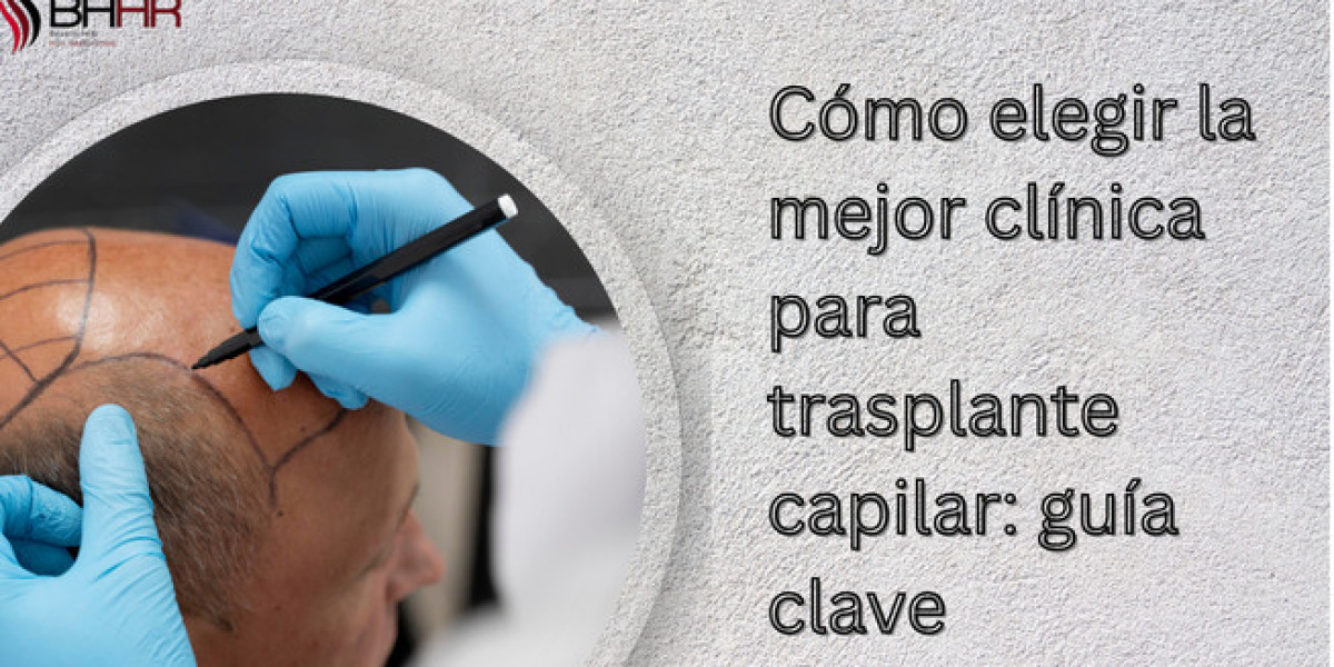 Cómo elegir la mejor clínica para trasplante capilar: guía clave