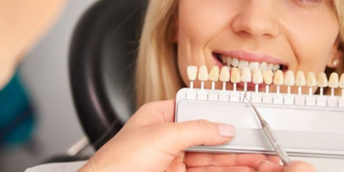 Why Dental Implants Leichhardt May Be Your Final Fix