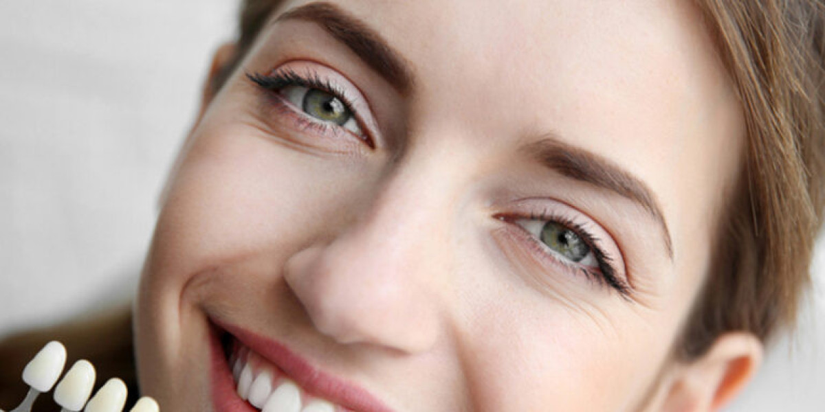 Cosmetic Dentistry Marrickville Transforms Local Smiles