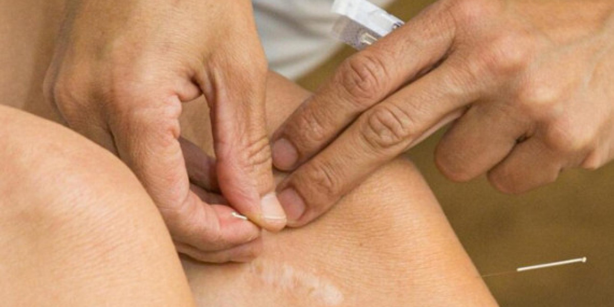 Can Homeopathy Be Combined With Other Treatments For Vitiligo?