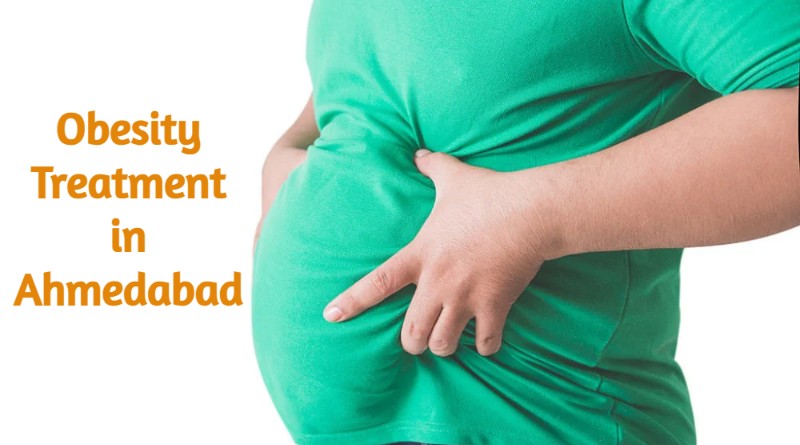Best Obesity Treatment in Ahmedabad | Mission GoodLife